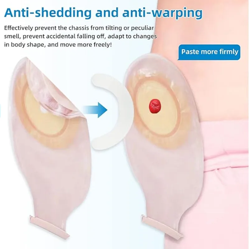 Medical Ostomy Bag Reinforceme - đánh giá và giá Medical Tape